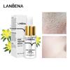 LANBENA Serum Original Essence 15ml (4 Types - New Version) Skincare Products