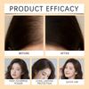 Hair Concealer Hair Concealer Hair Concealer Stick Fits Naturally Without Being Jarring Or Increasing Hair Volume