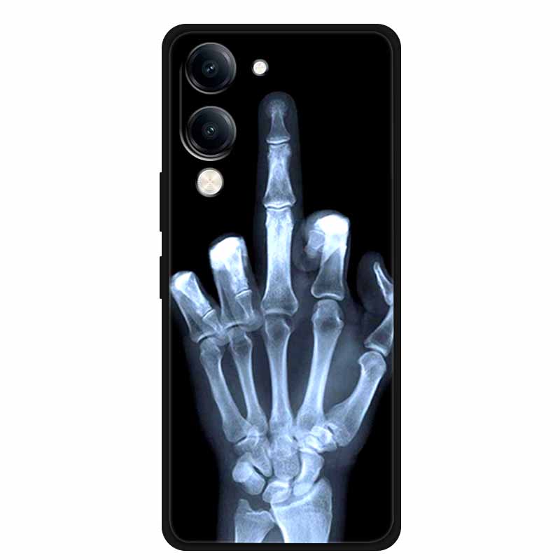 Case For Vivo Y04 Y04S Y37C 4G Soft Silicone TPU Protector Shell Cartoon Lovely Gift Anime Phone Cover Capa Y 04 04S 37C Bumper