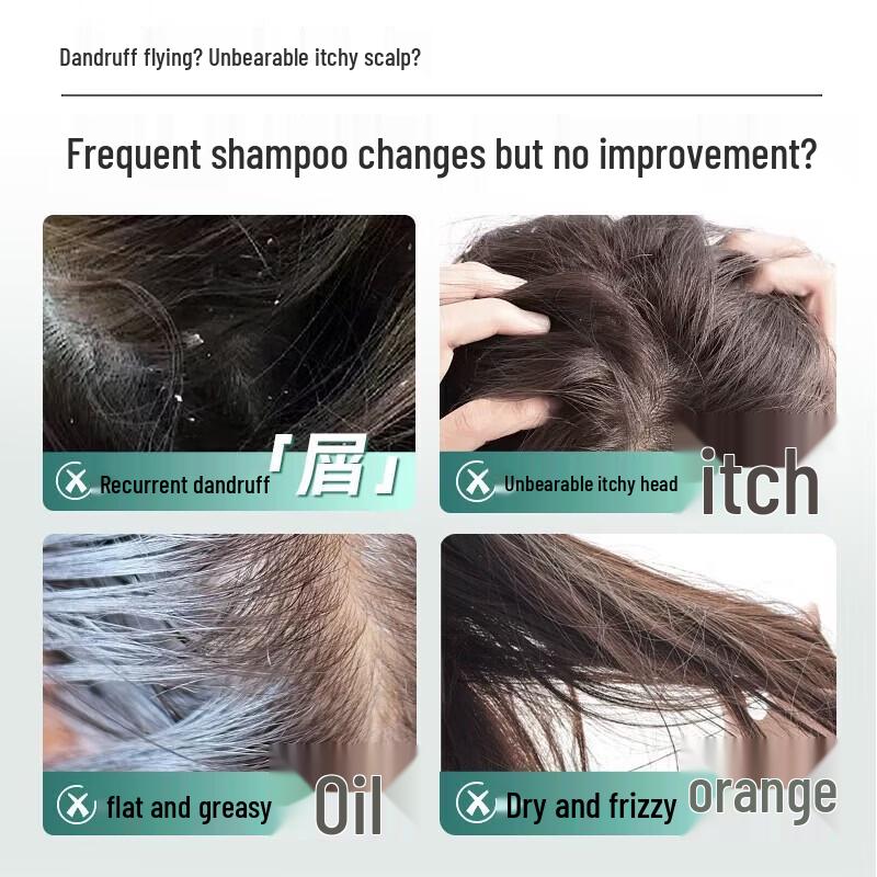 Slek Oxygen Activated Oil Control Anti-Dandruff Shampoo