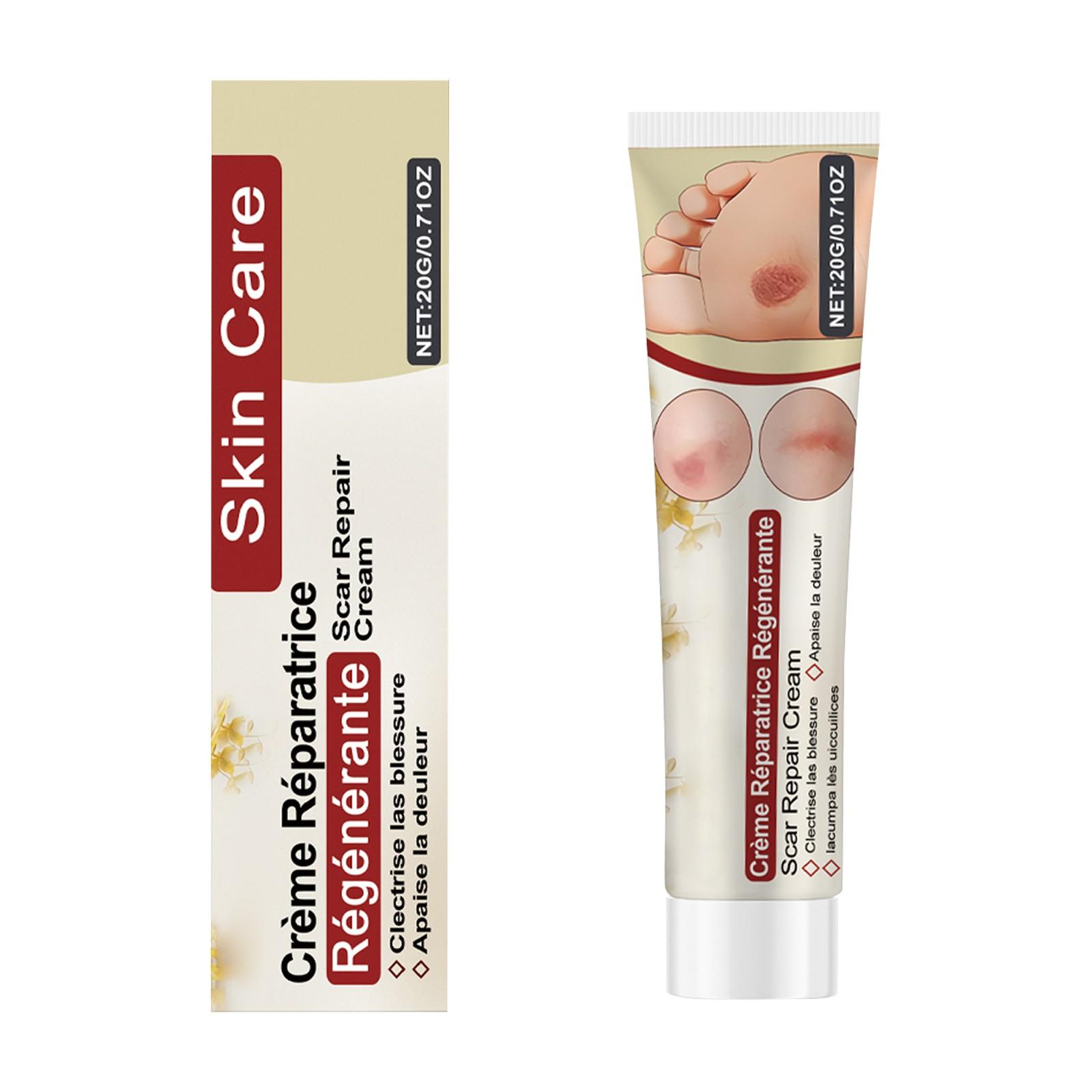 

Крем от шрамов — это крем для ухода за кожей, предназначенный для улучшения внешнего вида шрамов и разглаживания кожи. белый