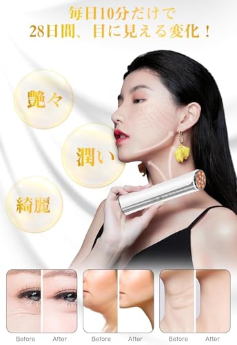 2025 New Model EMS Beauty Device, RF Facial Beauty Device with EMS Microcurrent, 4-Color LED, and Light Esthetics. Multi-Function Ion Facial Beauty De