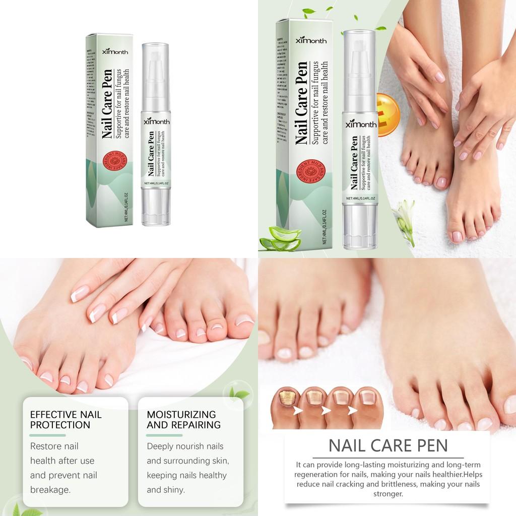 Ximonth Grauer Nagelpflege Stift Nährende Und Feuchtigkeitsspendende Behandlung Für Gesunde Zehen