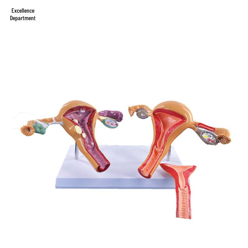 

Усовершенствованная модель женской патологической матки для гинекологических исследований, моделирование анатомии репродуктивной/яичниковой структуры.