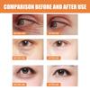 EELHOE Vitamin C Eye Cream Stick: Moisturizing, Soothing, and Refreshing for Eye Area Care