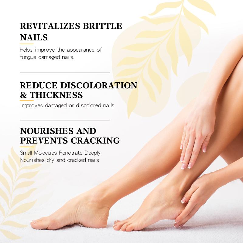 Nail Repair Essence Liquido Mani e Piedi Unghie Grigie Unghie Morbide Ingiallimento Unghie Spesse Lucide Pulizia Unghie Riparazione