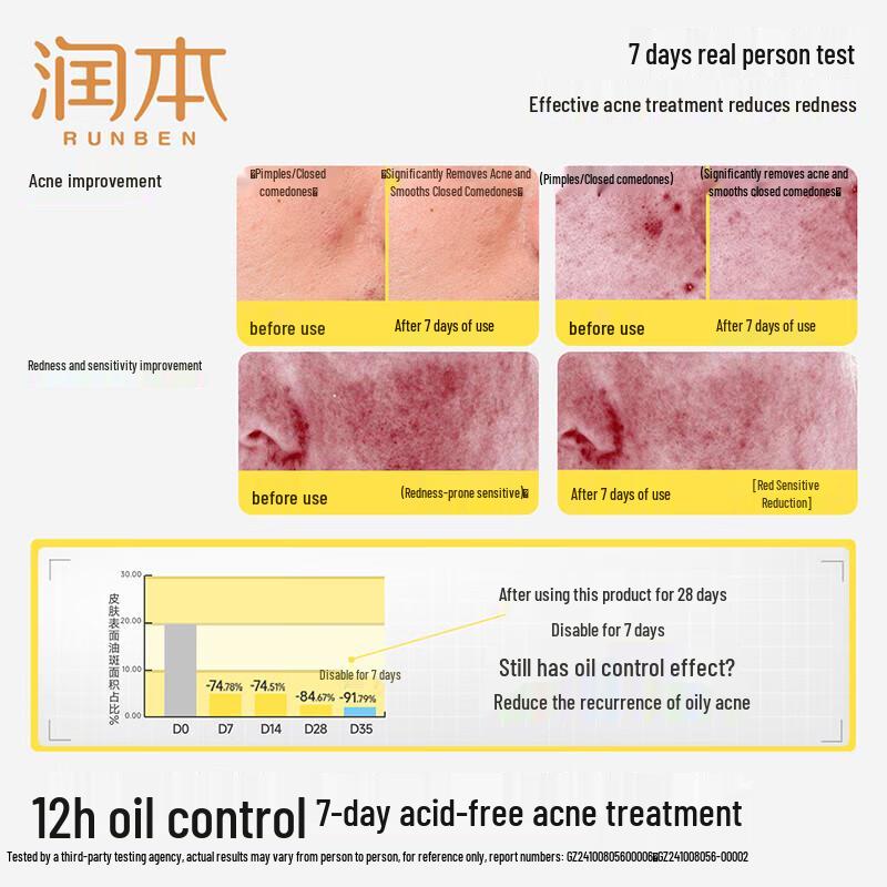 RUNBEN Teen Oil Control Acne Essence Toner