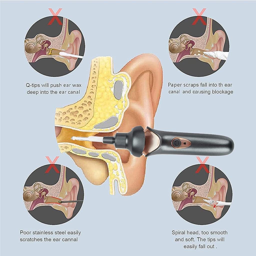 5-in-1 Electric Ear Scoop Electric Children's Ear Scoop Safety Painless Earwax Remover Cordless Vacuum Ear Wax Cleaning Tool Painless Ear Cleaning