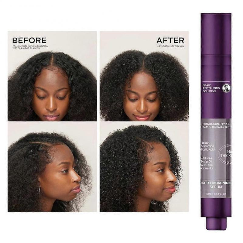 suitable for Dr. Groot Award-Winning Hair Thickening Serum for Hair Loss