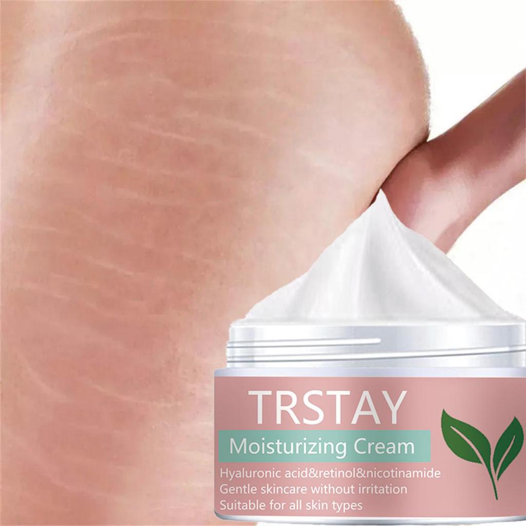 Gentle and Non-irritating, the Smoothing Skin Stretch Mark Cream Smooths Wrinkles, Fades Fine Lines, and Leaves Skin Soft and Refined
