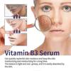 B3 Serum, Dark Spot Corrector B3 Serum With Anti-Aging 10% Niacinamide Discoloration Correcting Serum for Sun Spots, Age Spots