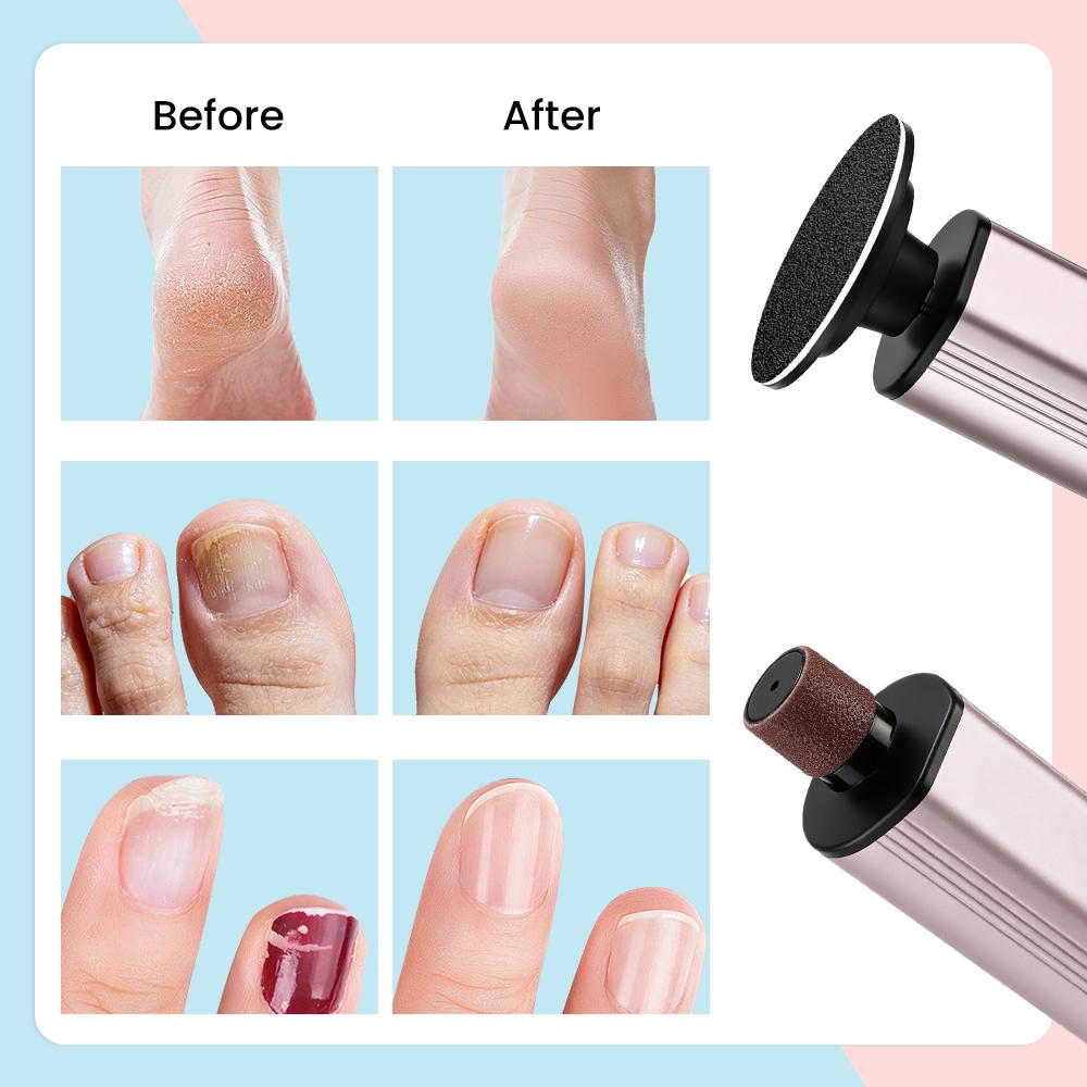 Cordless Electric Foot Grinder 9 Speeds Callus Remover with 20PCS Sandpaper Rechargeable Pedicure Tools for Smooth Feet