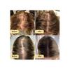 5 Bottles of Vegan Organic Hair Growth Oil, Rosemary Oil for Hair Growth, Organic Hair Treatment 60 Ml