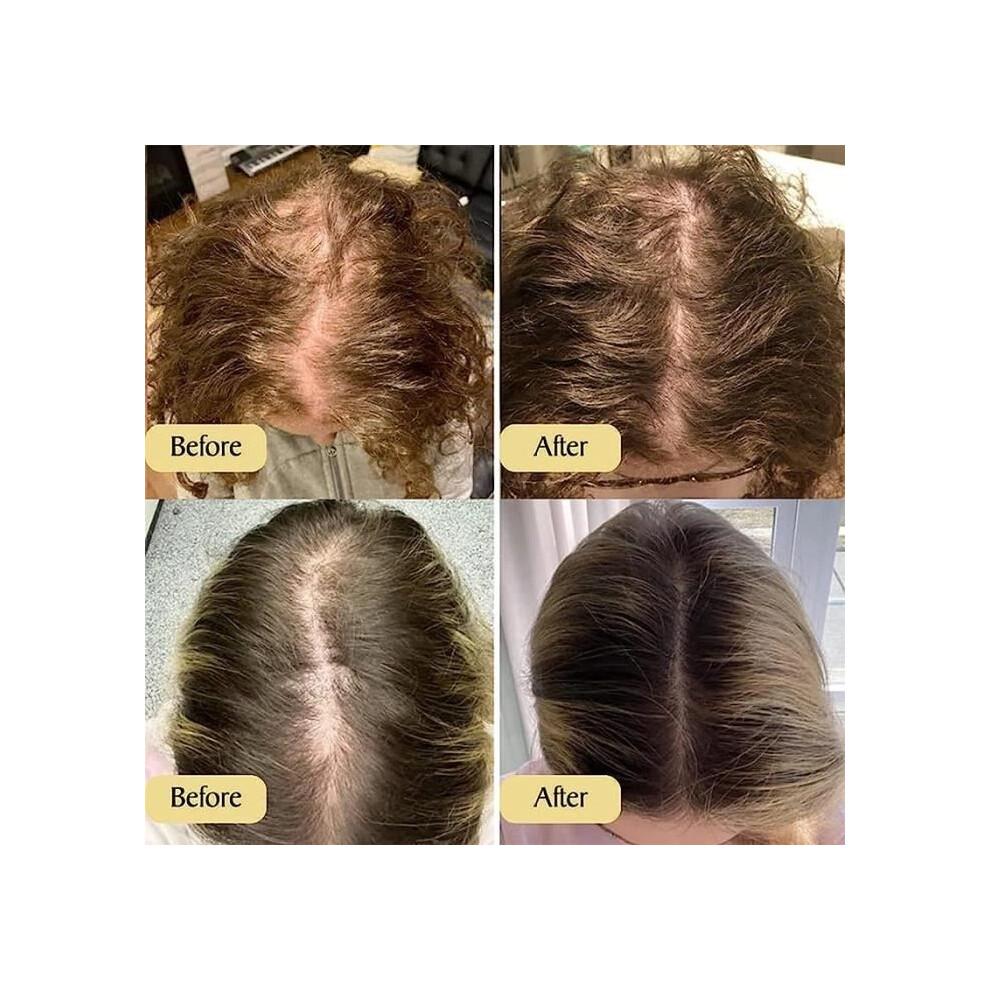 5 Bottles of Vegan Organic Hair Growth Oil, Rosemary Oil for Hair Growth, Organic Hair Treatment 60 Ml