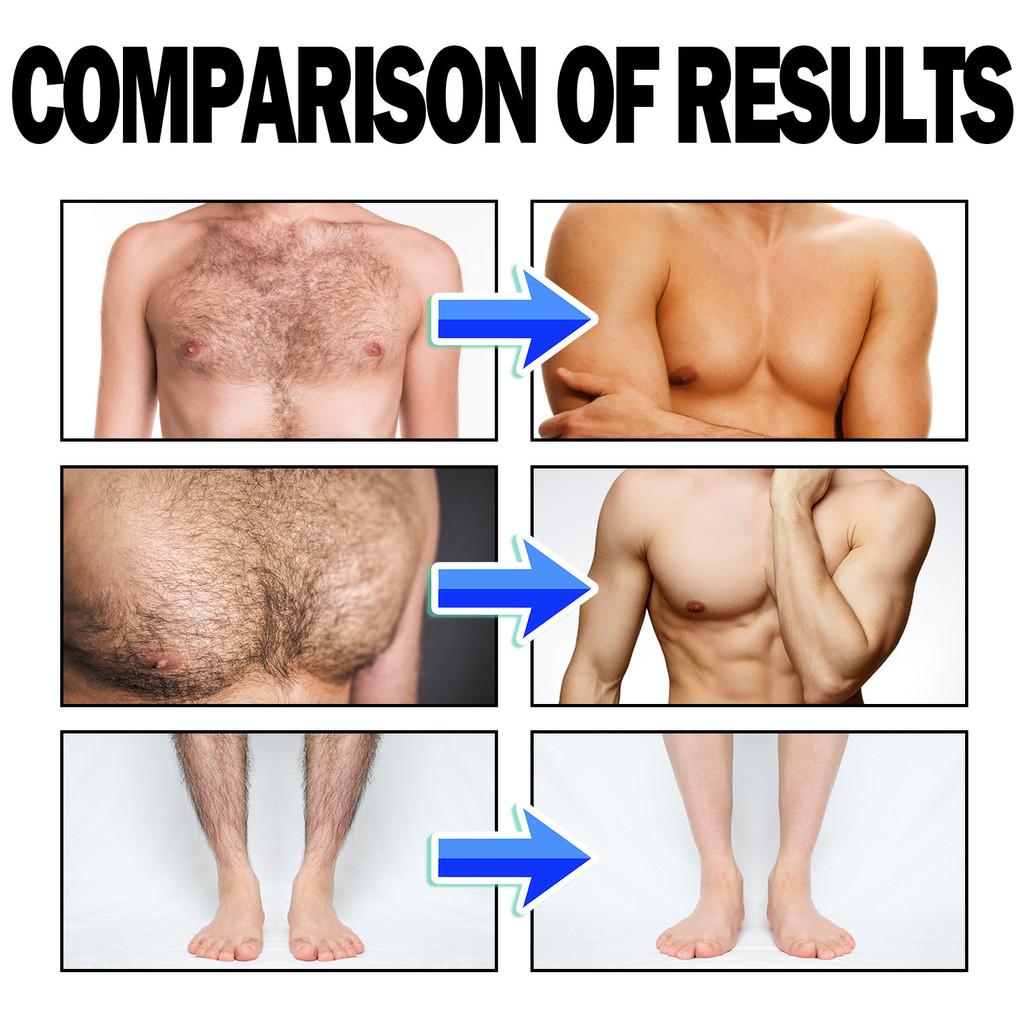 Eelhoe Men's Hair Removal Mousse Gentle And Soothing Formula For Body And Chest