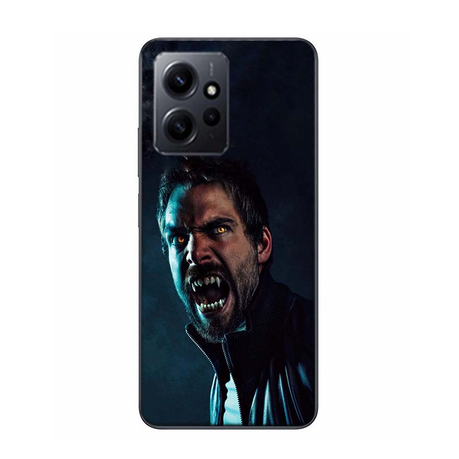 Teen Wolf Luxury Phone For Xiaomi Redmi Note 14+ 13 K70 Pro Plus Redmi 13C 14C 12C 12 10 10A 10C 9 9A 9C 9T 8 8A Cover Clear TPU