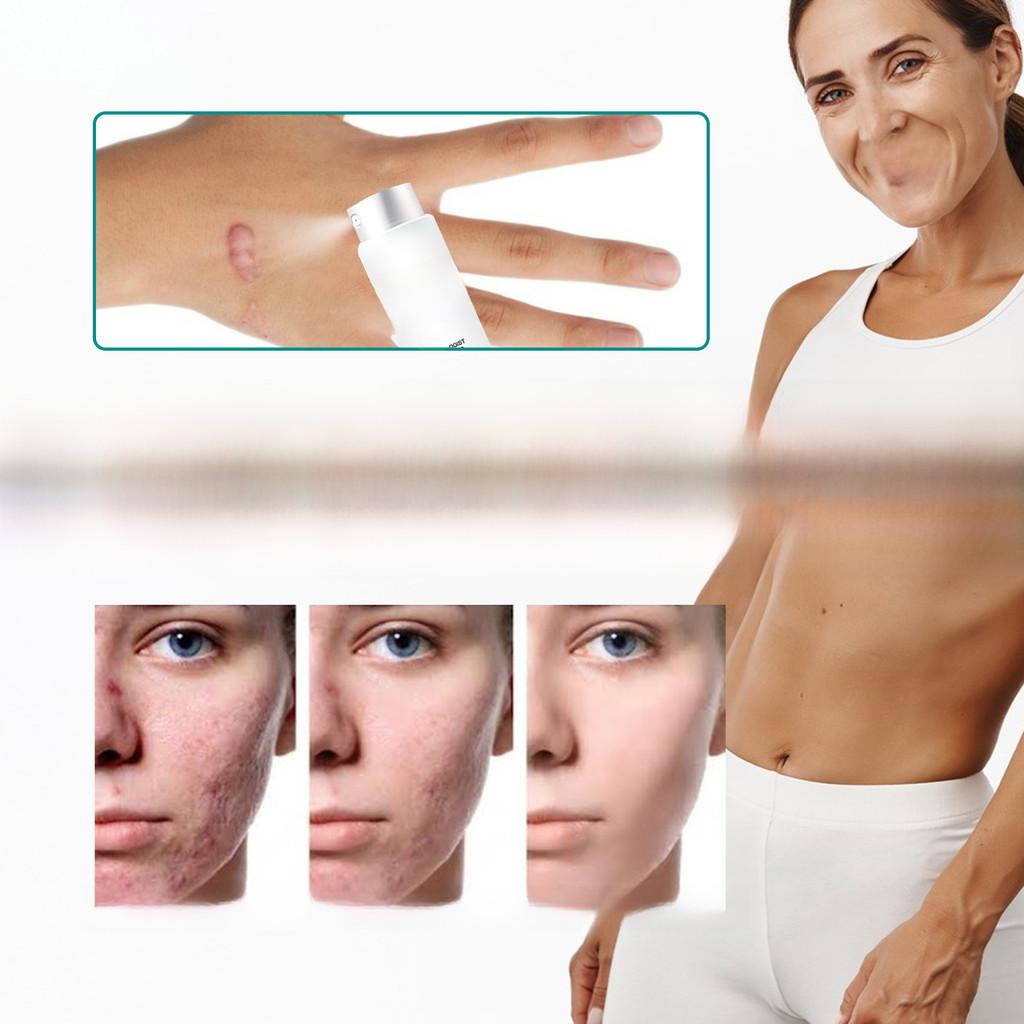 South Moon Scar Care Spray Smooth Skin Healing Reduce Burn Scars Pregnancy Marks