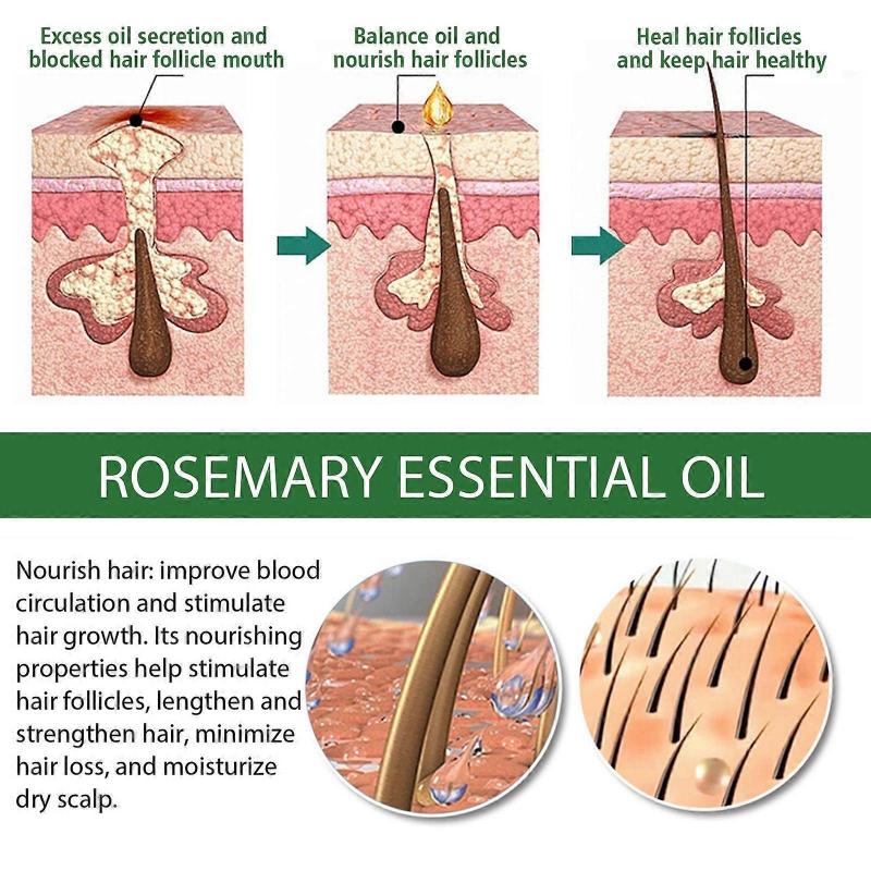 Multi-effect Rosemary Essential Oil Strong Firm Hair Moisturizing Thick Hair Skin Care Multi-effect Essential Oil