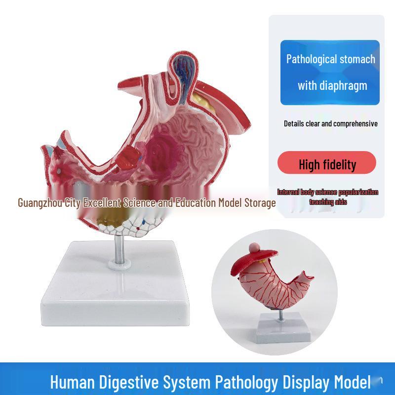 Digestive System Anatomy Model: Human Stomach Structure and Pathology for Medical Display