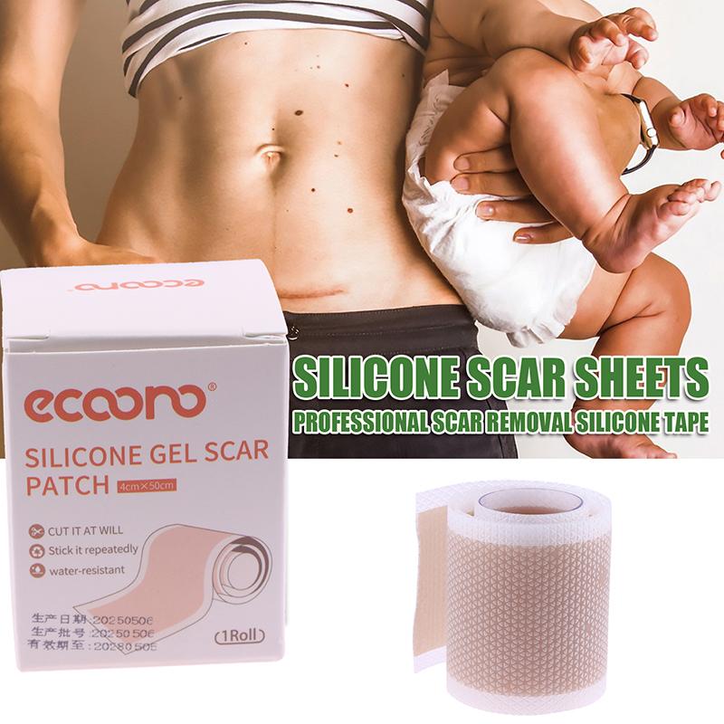 

5 м/рулон Силиконовый пластырь от рубцов Рулон ленты от рубцов Лист для удаления рубцов Самоклеящаяся лента Терапевтический пластырь Ожог Акне Хирургический шрам Уход за кожей one size