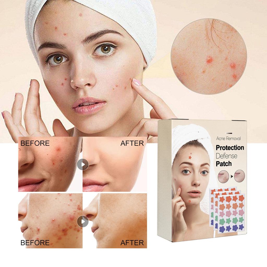 Large Capacity Pimple Patches, Colorful Cute Zit Covers,Hydrocolloid Acne Patches With Tea Oil, Witch Hazel, Centella Asiatica , Hyaluronic Sour