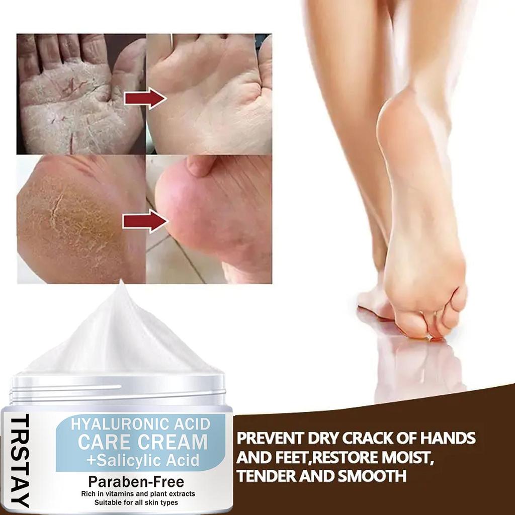 Chapped Feet & Feet Repair Cream er mild og ikke-irriterende, fukter og nærer huden