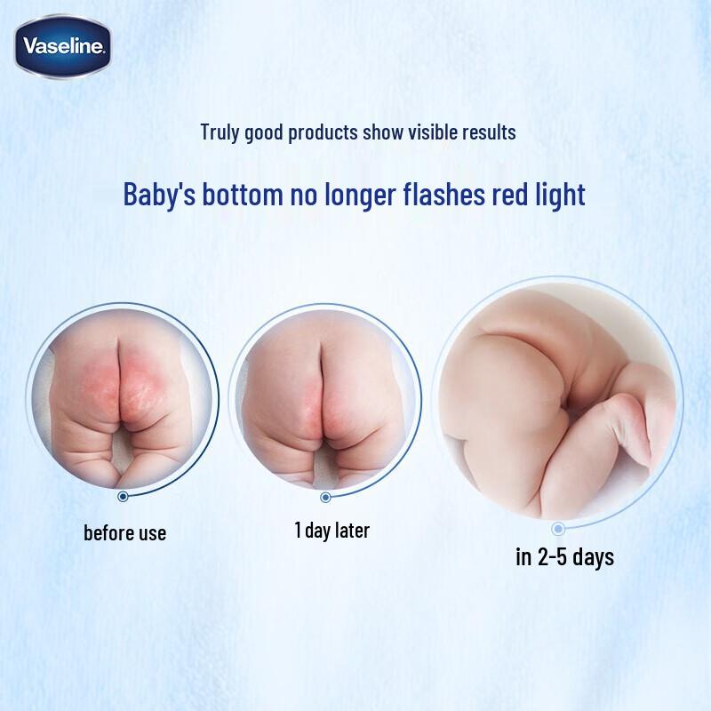 Vaseline Classic Baby Healing Jelly