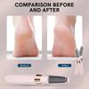 Portable USB Electric Foot Grinder File Vacuum Hard Remover Callus Skin