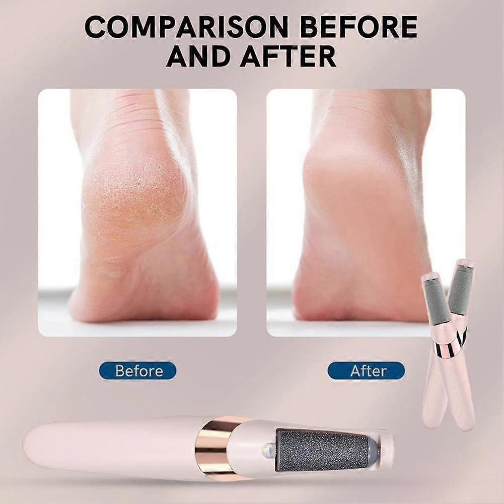 Portable USB Electric Foot Grinder File Vacuum Hard Remover Callus Skin