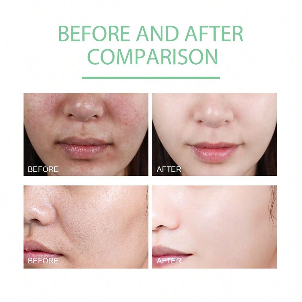 Herbal Facial Gel Gentle Cleansing Moisturizing Soft Skin Care Refreshing Cleanse Natural Skincare Gel for Sensitive Skin