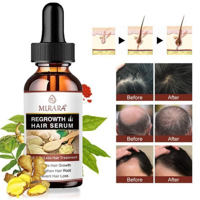 Hair Essence Oil 5 Natural Ginger Hair Oil Anti Hair Loss Prevention Baldness Treatment Quick Nourishing Scalp Hair Care