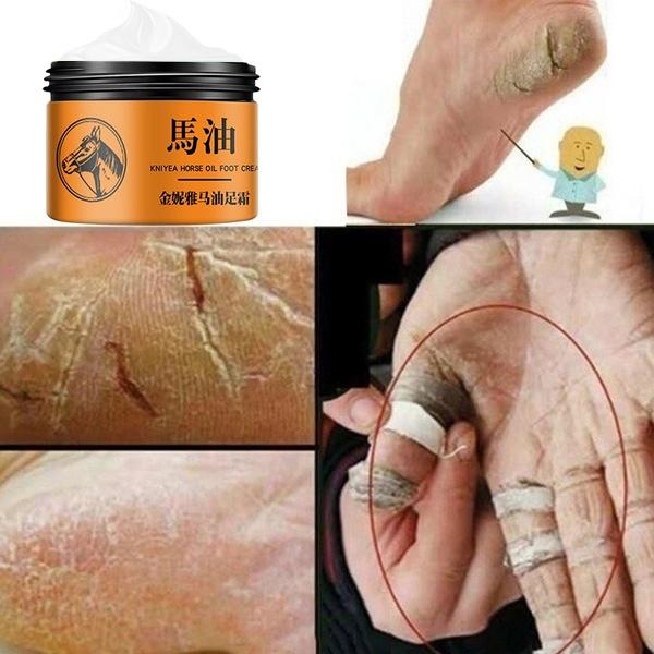 1 Box Horse Oil Hand And Foot Repair Cream Skin Moisturizing Foot Skin Care