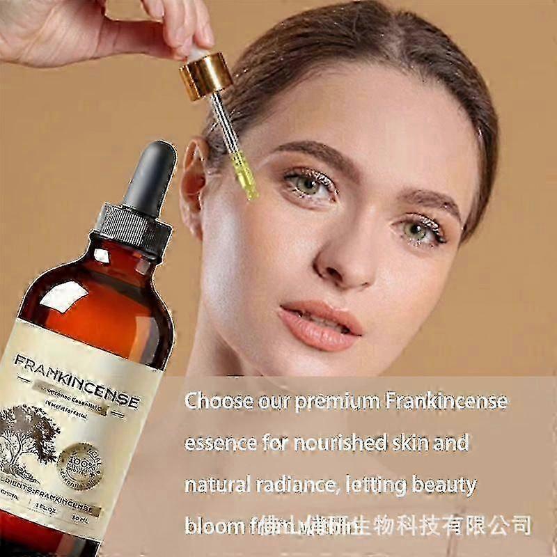 Frankincense Essential Oil, 1pc Pure Natural Premium Grade for Diffuser Aromatherapy Nourish Skin