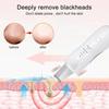 Deep Vibrate Ultrasonic Skin Scrubber Scrubber Deep Vibrate Facial Cleaner Shovel Face Scrubber Peeling Black Head Remover Facial Massager