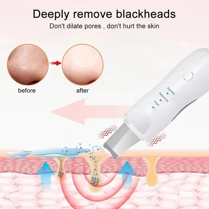 Deep Vibrate Ultrasonic Skin Scrubber Scrubber Deep Vibrate Facial Cleaner Shovel Face Scrubber Peeling Black Head Remover Facial Massager