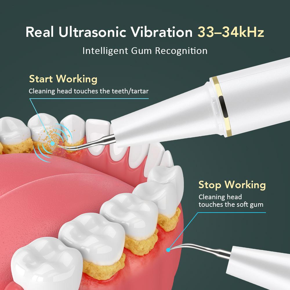Visual Ultrasonic Dental Scaler with Camera Electric Plaque Cleaner Tartar Stain Calculus Remover Oral Care Teeth Whitening