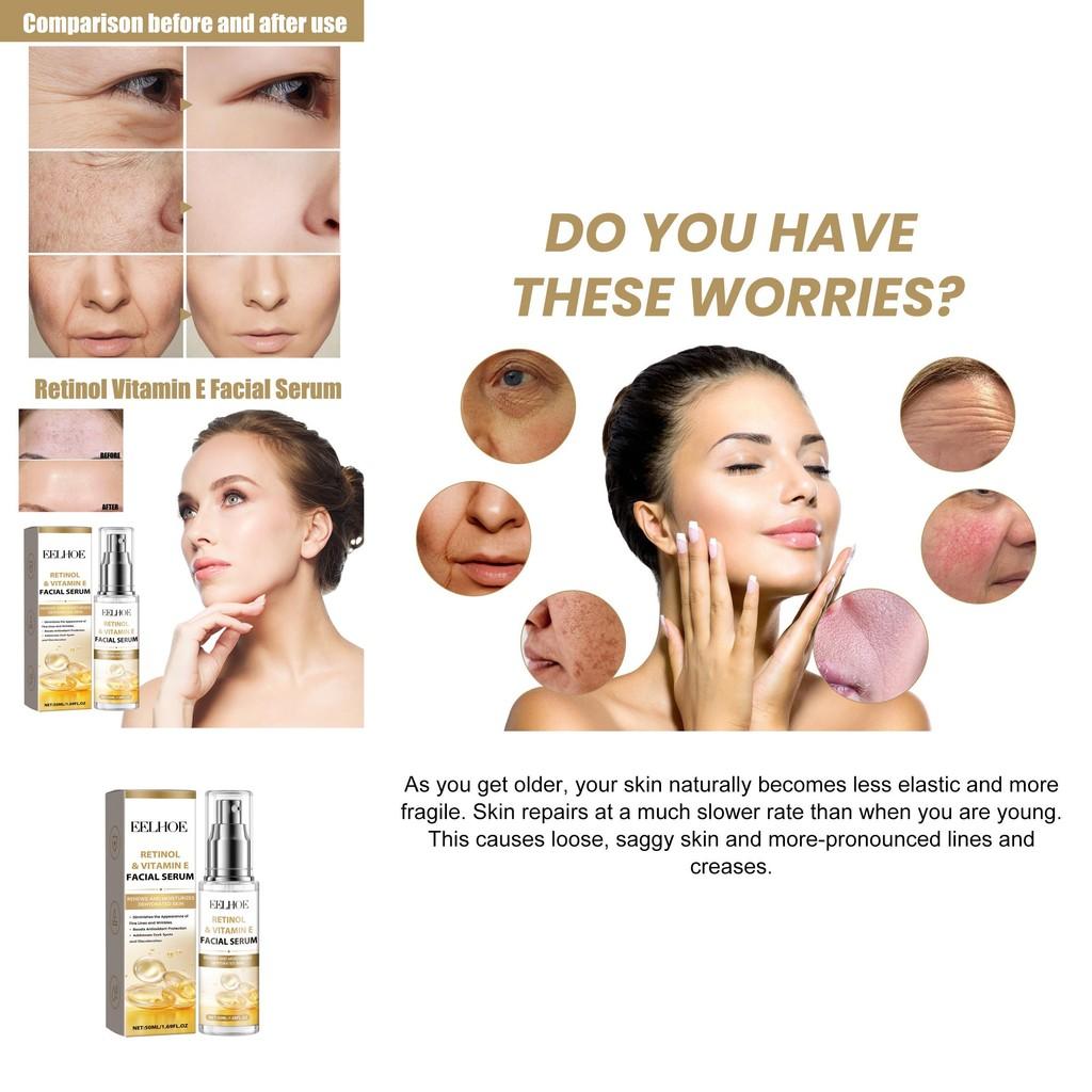 Eelhoe Retinol Vitamin E Night Facial Serum For Radiant Skin Hydrating Brightening Essence