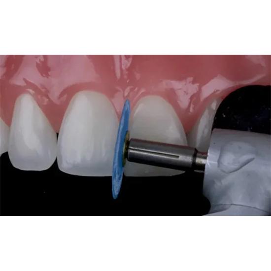 ET Dental Polishing Discs With Rivets Kit