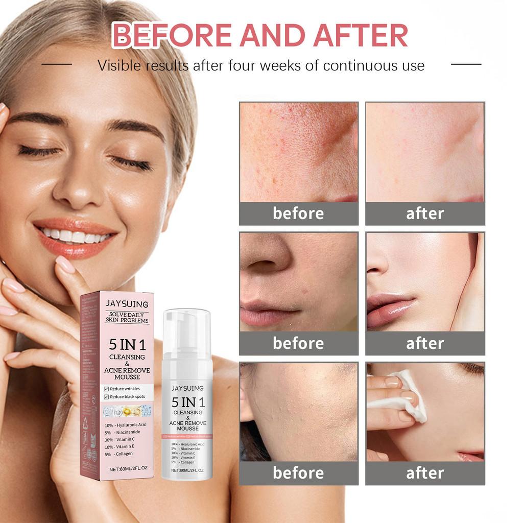 Jaysuing 5 In 1 Cleansing Mousse For Deep Pore Cleansing And Oil Control 60ml