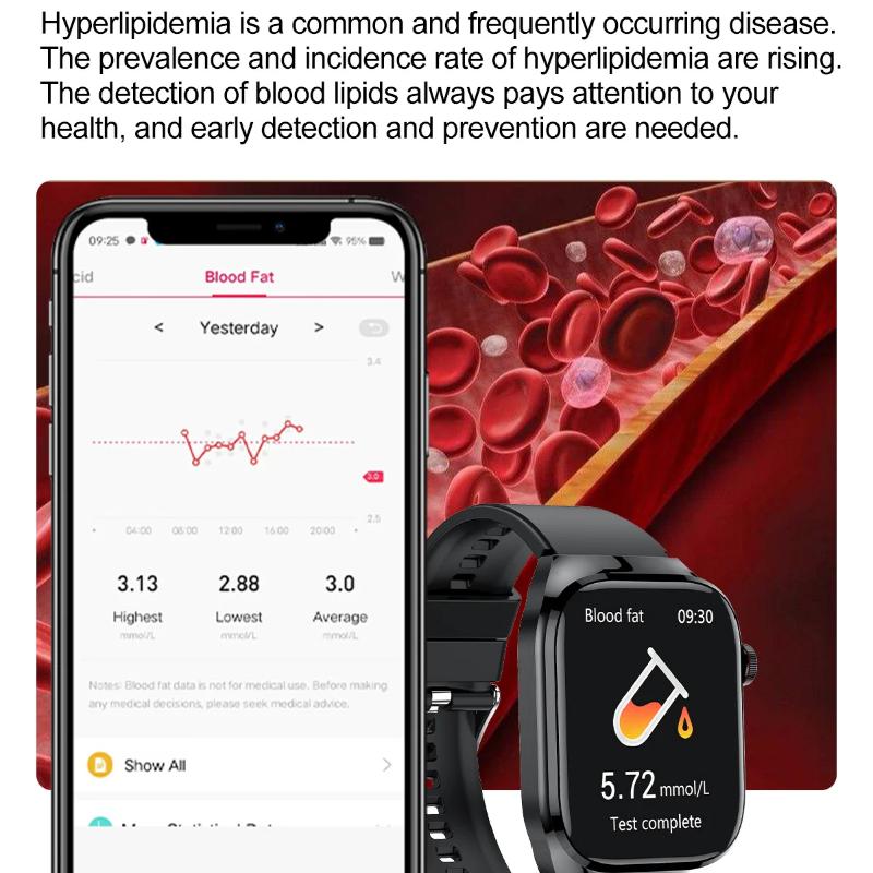 2025 Νέο Ακριβές Ρολόι Smartwatch Μέτρησης Λίπους Αίματος και Ουρικού Οξέος Ανδρικό Μικροφυσική Εξέταση Υγεία Πέντε Οργάνων HealthClock Κλήση Bluetooth Smartwatch