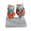 Thyroid Pathology Model: Hyperthyroidism & Hypothyroidism Teaching Aid