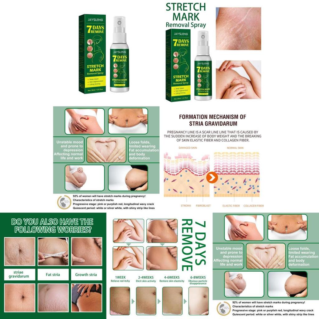 Jaysuing Skin Care Spray For Postpartum Skin Firming And Fine Line Reduction In 30ml Packaging