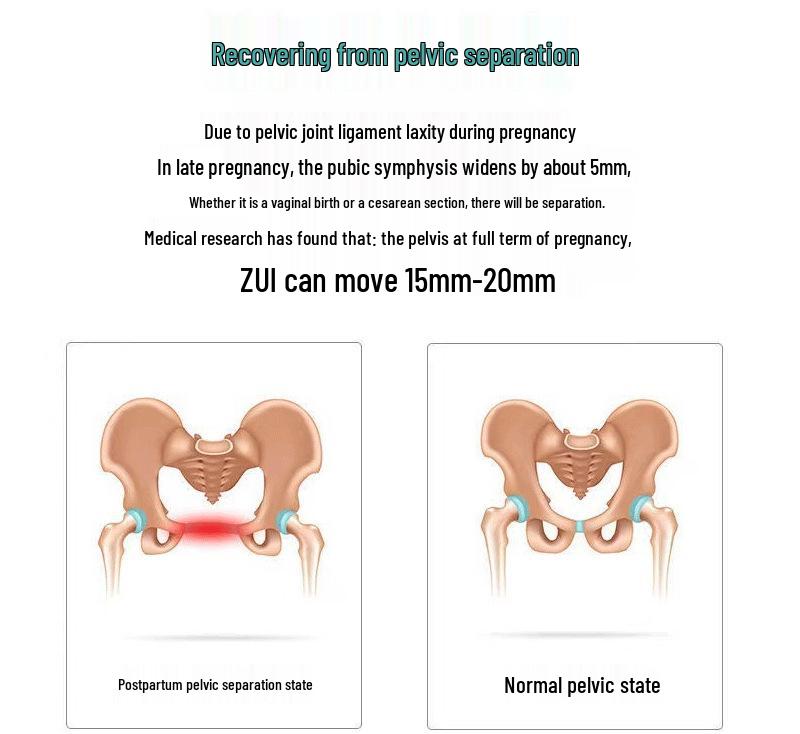 Pelvic Girdle Belt: Postpartum & Pregnancy Support for Hip Shaping & Waist Cinching