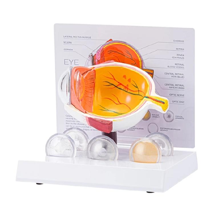 Anatomical Pathological Eyeball Model Human Eyeball Anatomy Model Pathological Eyeball Anatomy Model for Teaching Tool 1