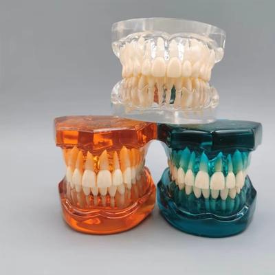 Zahnmedizinisches Lehr-Modell Ortho Metall/Keramik Mit/Ohne Bracket Zahnmedizinische Zubehörteile Kieferorthopädie Zahnersatz Modellierwerkzeug
