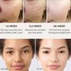 Anti Aging Anti Eye Bags Odstraňuje vrásky Hydratační péče o obličej