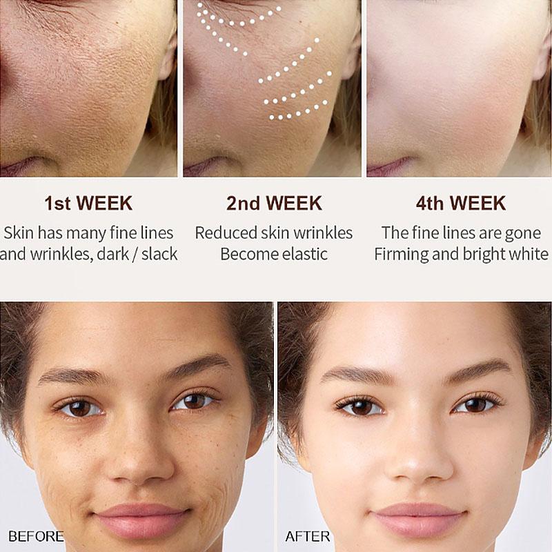 Anti Aging Anti Eye Bags Odstraňuje vrásky Hydratační péče o obličej