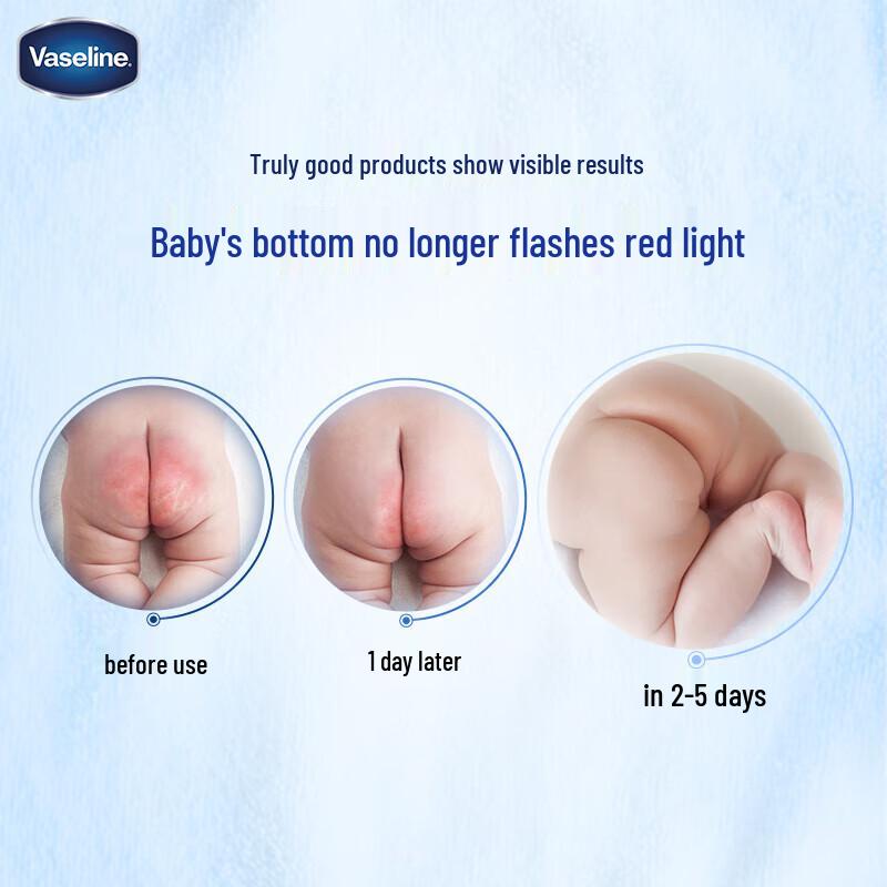 Vaseline Baby Classic Protective Jelly