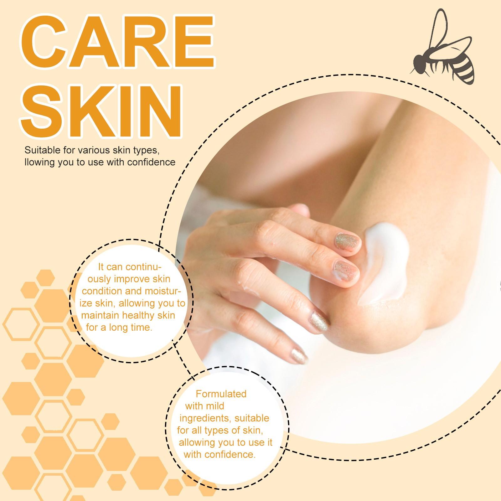 Уход за пчелиным коровьим мхом снимает зуд — фото 8