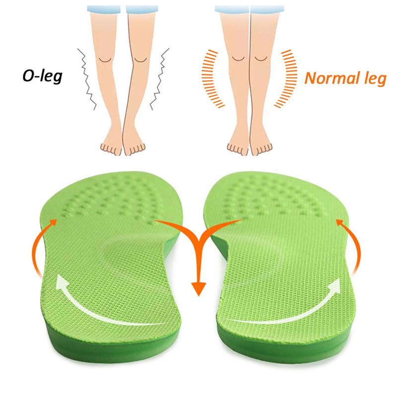 PU Orthopedic Arch Support Insoles O/XO Leg Corrected Shoe Sole Pads For Foot Valgus Varus Orthotic Cushion Pain Relief Inserts